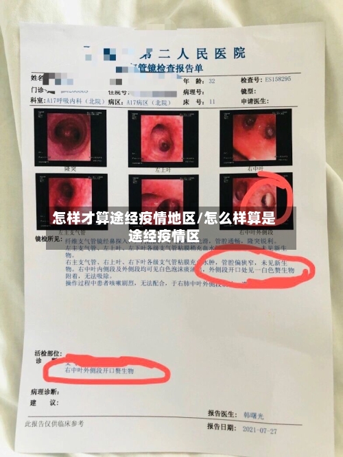 怎样才算途经疫情地区/怎么样算是途经疫情区