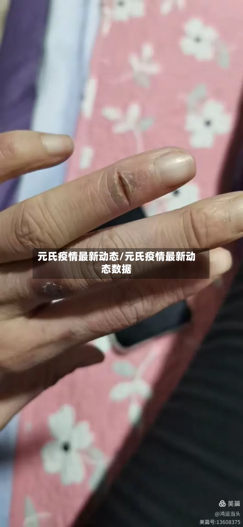 元氏疫情最新动态/元氏疫情最新动态数据-第1张图片