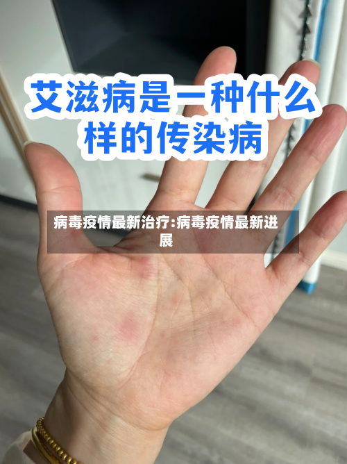 病毒疫情最新治疗:病毒疫情最新进展-第1张图片