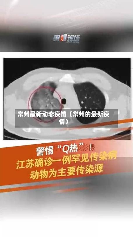 常州最新动态疫情(常州的最新疫情)-第1张图片